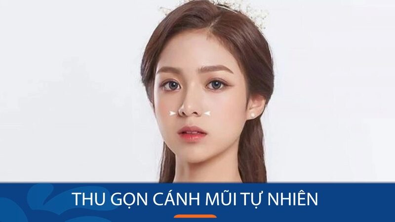 Cơ sở thu gọn cánh mũi Hà Nội: Kangnam (Nguồn: Internet)