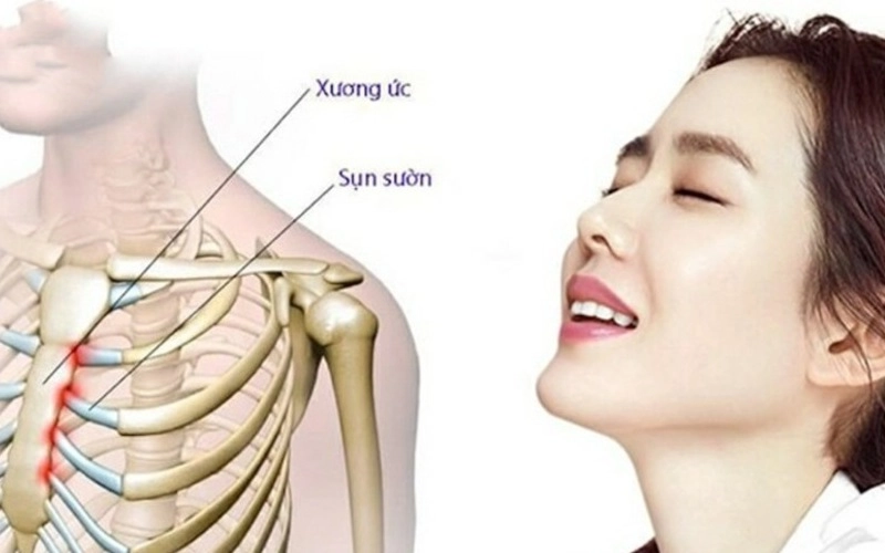 Tìm hiểu phương pháp nâng mũi bằng sụn tự thân (Nguồn: Internet)