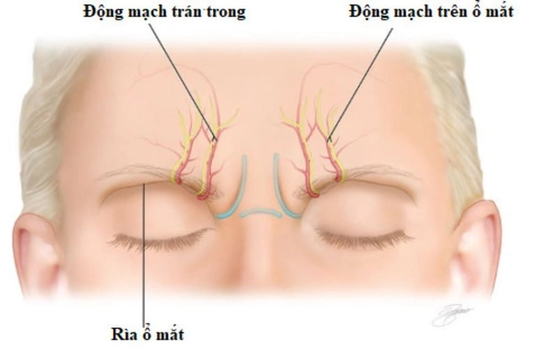 Hai phương pháp phẫu thuật cắt cơ cau mày là xóa cơ cau mày và cắt cơ cau mày (Nguồn: Internet)