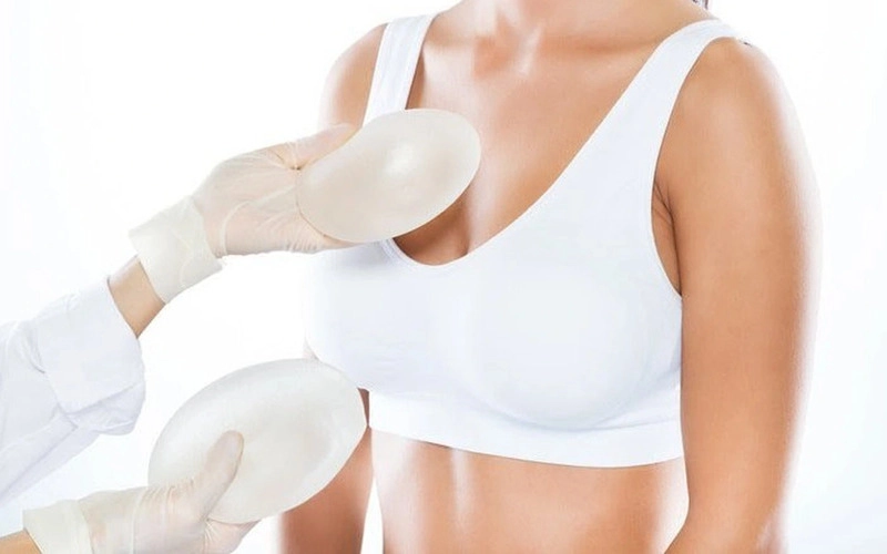Cách chọn túi nâng ngực phù hợp