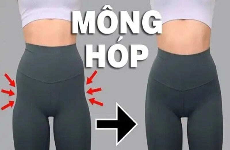MD Change Life - Giúp bạn lấy lại vòng 3 bằng cách cấy mỡ hõm mông (Nguồn: Internet)
