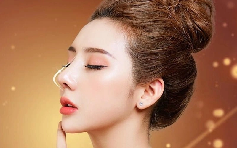 Nâng mũi giúp cải thiện những khuyết điểm về mũi, mang lại chiếc mũi hài hoà, tỷ lệ hơn so với cấu trúc gương mặt. (Nguồn: Internet)