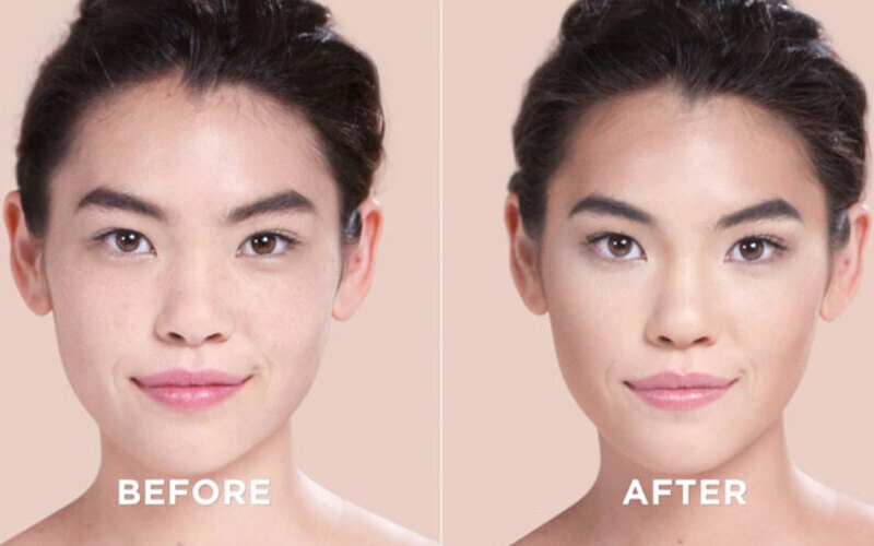 Nâng mũi đẹp tự nhiên: Bí quyết sở hữu dáng mũi hoàn hảo
