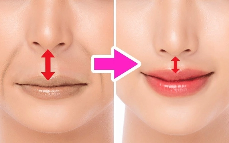 Top 5 địa chỉ thu ngắn nhân trung tại Nghệ An