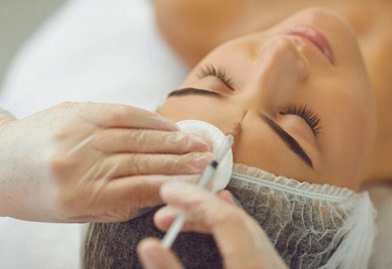 Vị trí tiêm botox cau mày (Nguồn: Internet)
