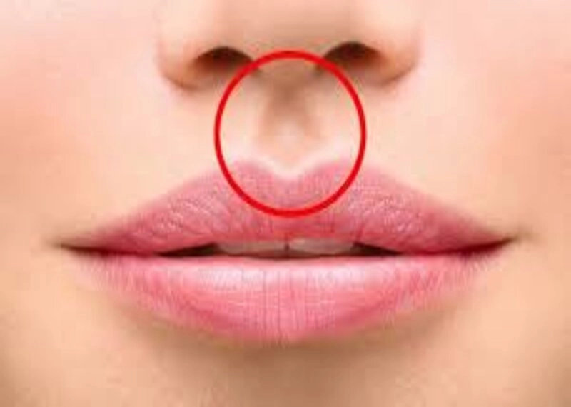 Hình dạng nhân trung như thế nào là đẹp? (Nguồn: Internet)
