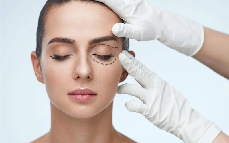 Sụp Mí: Giải Mã Nguyên Nhân, Triệu Chứng & Cách Điều Trị Hiệu Quả
