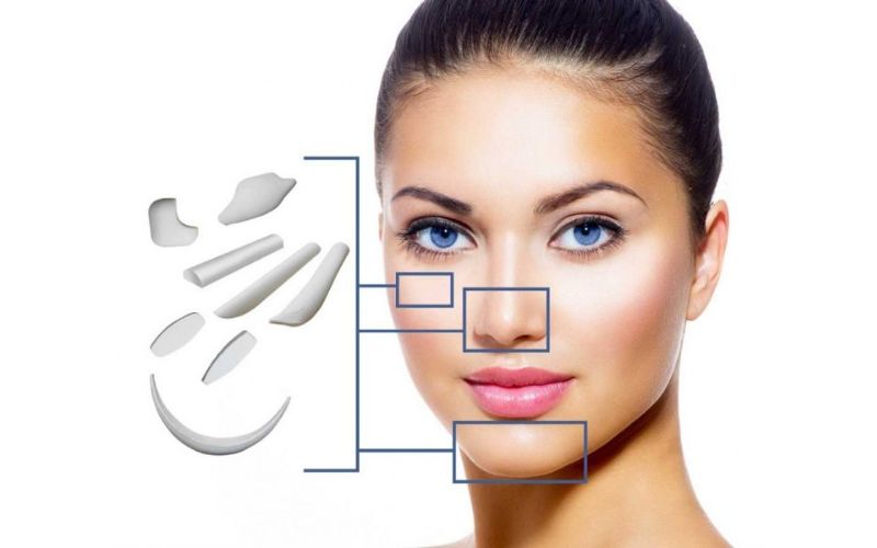 Nâng mũi cấu trúc Surgiform sử dụng chất liệu sụn Surgiform cao cấp để tái cấu trúc toàn diện cấu trúc mũi (Nguồn: Internet)