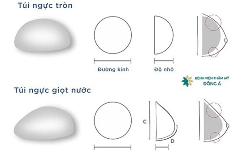 Nâng ngực giọt nước (Nguồn: Internet)