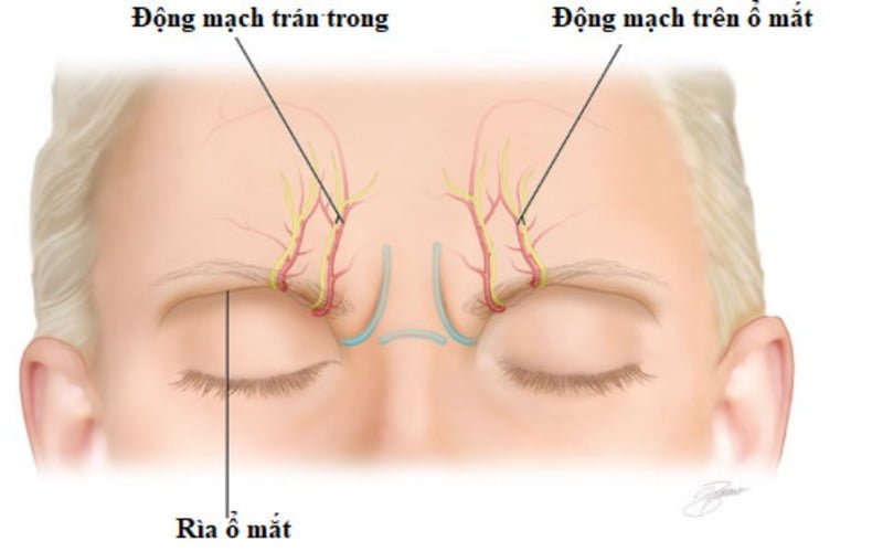 Hai phương pháp phẫu thuật cắt cơ cau mày là xóa cơ cau mày và cắt cơ cau mày (Nguồn: Internet)