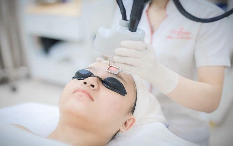 Xoá sẹo bằng phương pháp sử dụng laser (Nguồn: Internet)